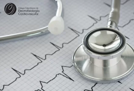 Me dijeron que tengo una arritmia cardiaca ¿Qué es eso?